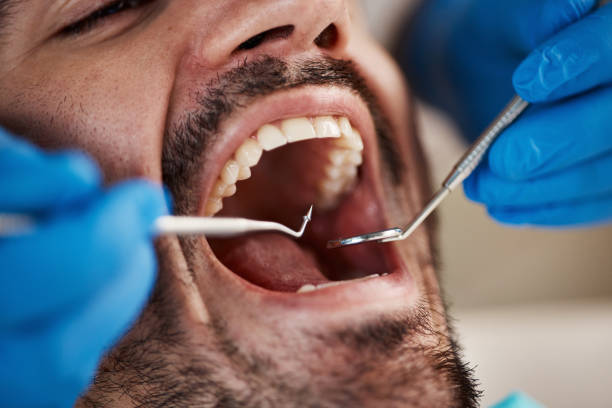 Best Emergency TMJ Treatment in Taylor Creek, FL